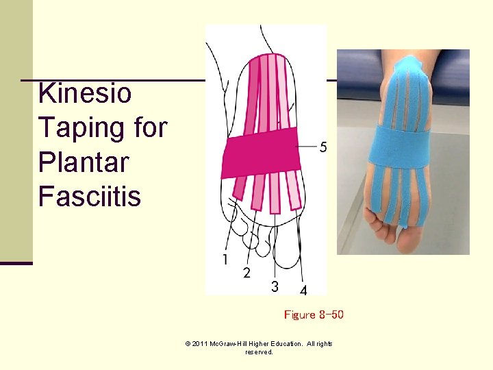 Kinesio Taping for Plantar Fasciitis Figure 8 -50 © 2011 Mc. Graw-Hill Higher Education.