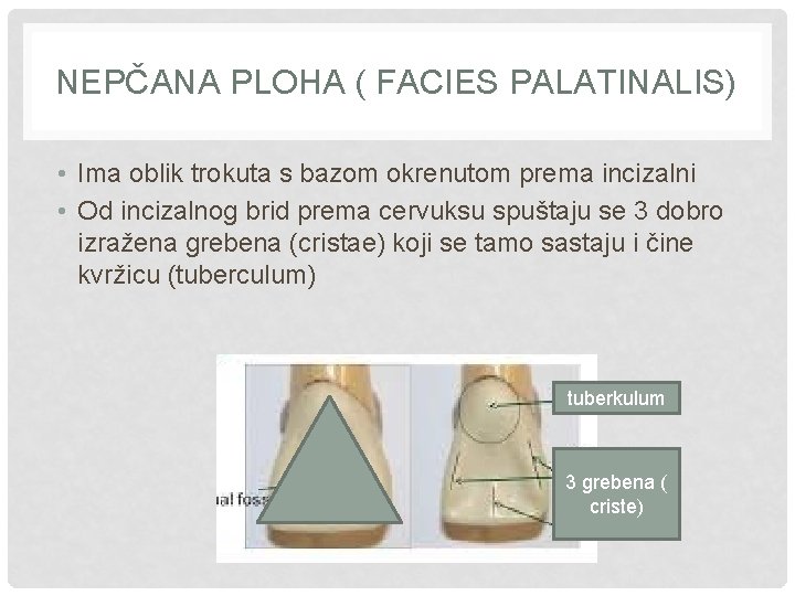 NEPČANA PLOHA ( FACIES PALATINALIS) • Ima oblik trokuta s bazom okrenutom prema incizalni