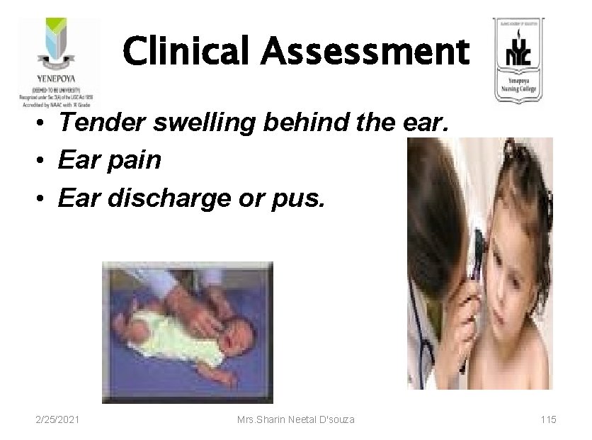 Clinical Assessment • Tender swelling behind the ear. • Ear pain • Ear discharge