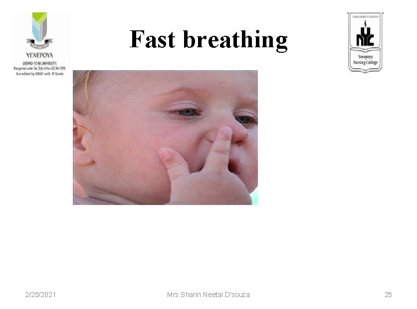 Fast breathing 2/25/2021 Mrs. Sharin Neetal D'souza 25 