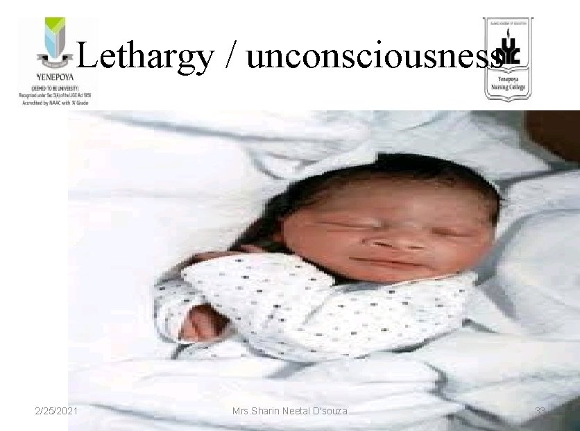 Lethargy / unconsciousness 2/25/2021 Mrs. Sharin Neetal D'souza 33 