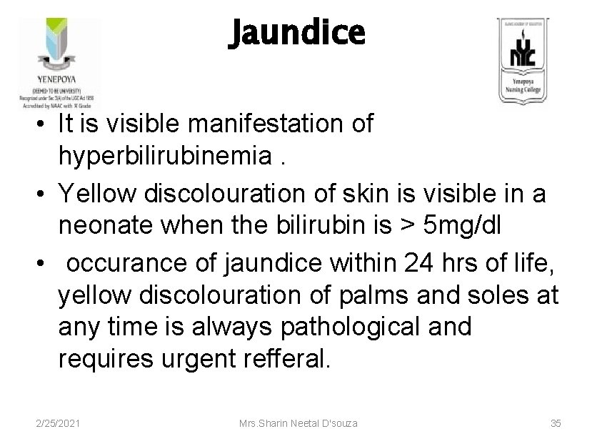 Jaundice • It is visible manifestation of hyperbilirubinemia. • Yellow discolouration of skin is