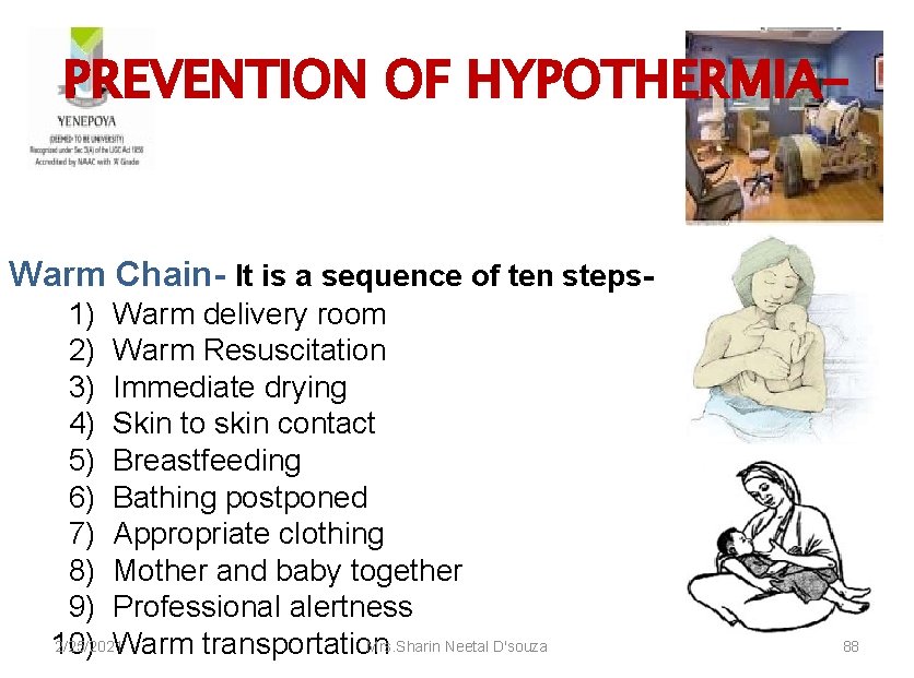 PREVENTION OF HYPOTHERMIA- Warm Chain- It is a sequence of ten steps 1) Warm