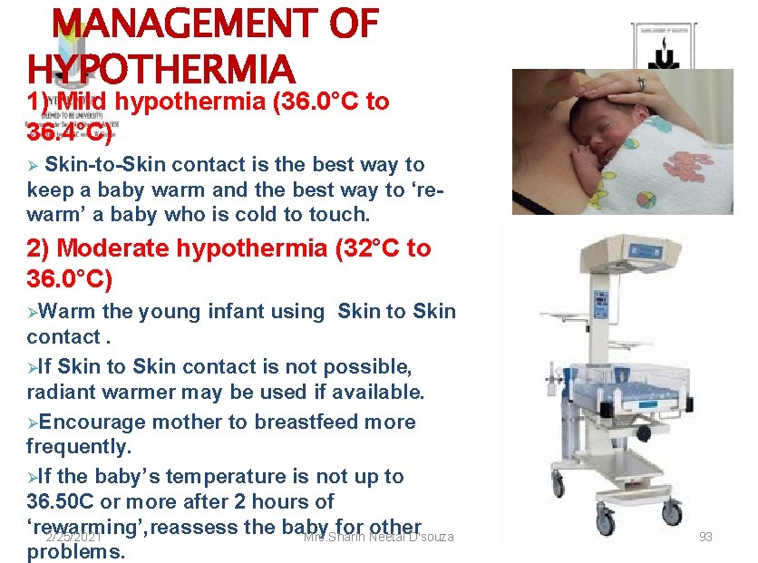 MANAGEMENT OF HYPOTHERMIA 1) Mild hypothermia (36. 0°C to 36. 4°C) Skin-to-Skin contact is