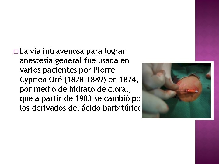 � La vía intravenosa para lograr anestesia general fue usada en varios pacientes por � La vía intravenosa para lograr anestesia general fue usada en varios pacientes por