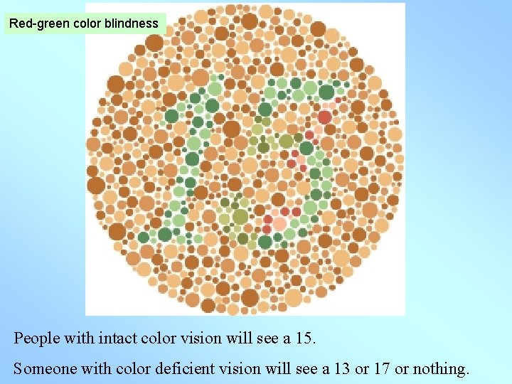 Red-green color blindness People with intact color vision will see a 15. Someone with