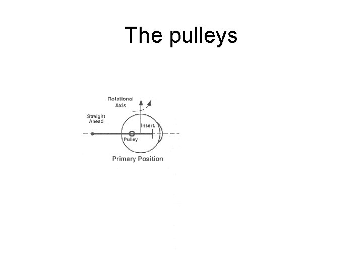 The pulleys 