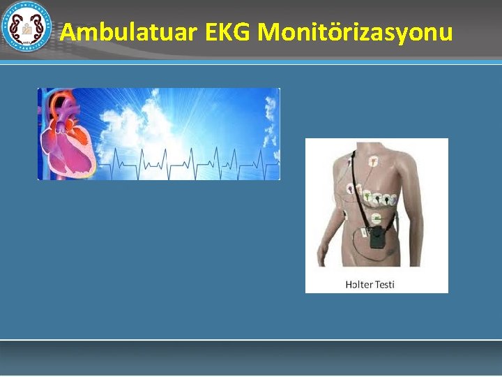 Ambulatuar EKG Monitörizasyonu 
