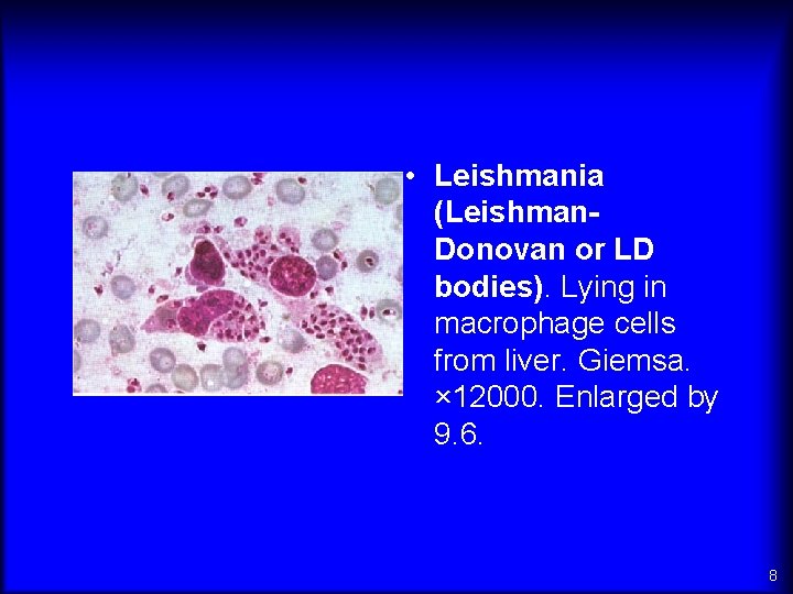  • Leishmania (Leishman. Donovan or LD bodies). Lying in macrophage cells from liver.