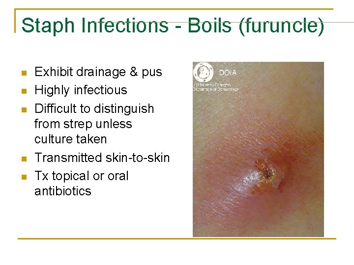 Staph Infections - Boils (furuncle) n n n Exhibit drainage & pus Highly infectious