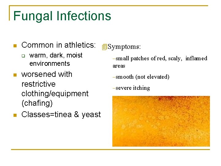 Fungal Infections n Common in athletics: 4 Symptoms: q n n warm, dark, moist