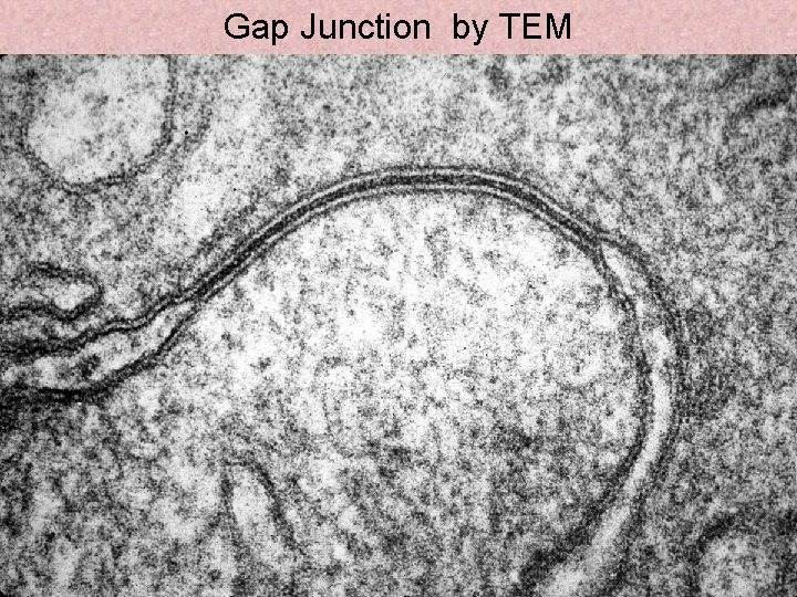 Gap Junction by TEM 4 -25 