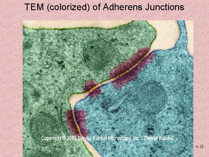 TEM (colorized) of Adherens Junctions 4 -28 