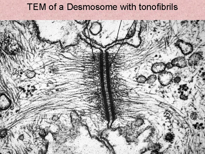 TEM of a Desmosome with tonofibrils 4 -29 