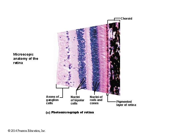 Choroid Microscopic anatomy of the retina Axons of ganglion cells Nuclei of bipolar cells