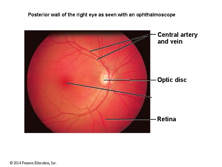 Posterior wall of the right eye as seen with an ophthalmoscope Central artery and