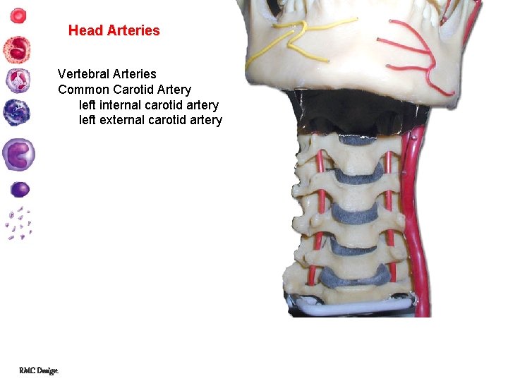 Head Arteries Vertebral Arteries Common Carotid Artery left internal carotid artery left external carotid