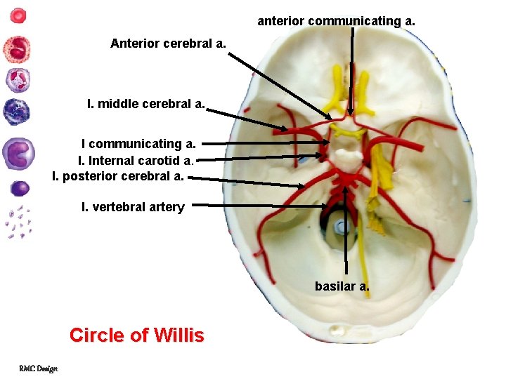 anterior communicating a. Anterior cerebral a. l. middle cerebral a. l communicating a. l.