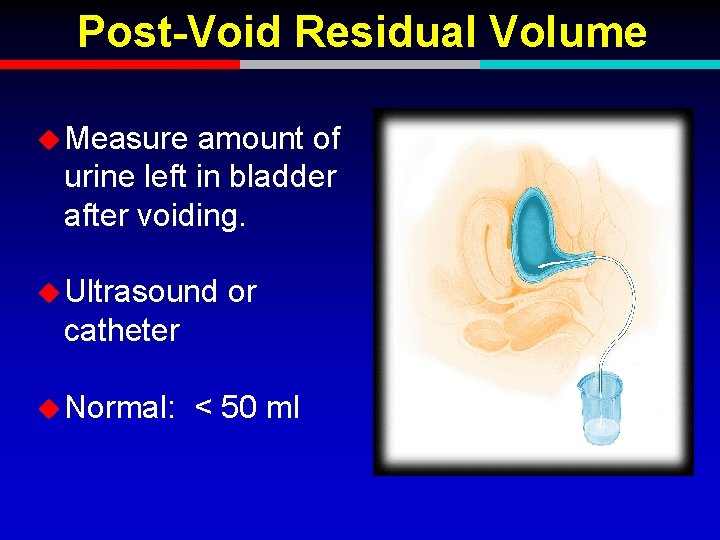 Post-Void Residual Volume u Measure amount of urine left in bladder after voiding. u