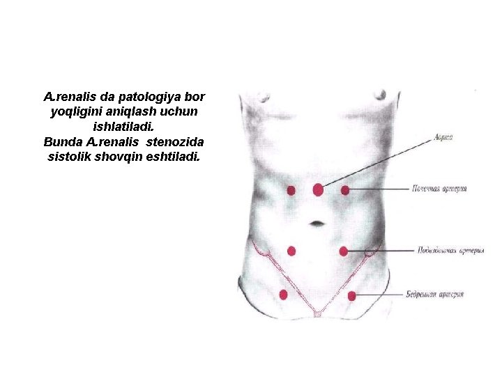 A. renalis da patologiya bor yoqligini aniqlash uchun ishlatiladi. Bunda A. renalis stenozida sistolik A. renalis da patologiya bor yoqligini aniqlash uchun ishlatiladi. Bunda A. renalis stenozida sistolik