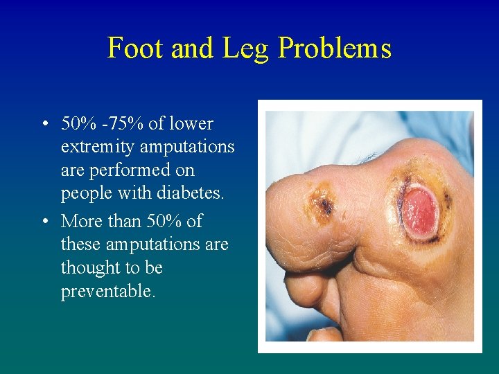 Foot and Leg Problems • 50% -75% of lower extremity amputations are performed on