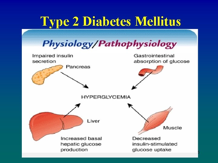 Type 2 Diabetes Mellitus Etiology and Pathophysiology 16 