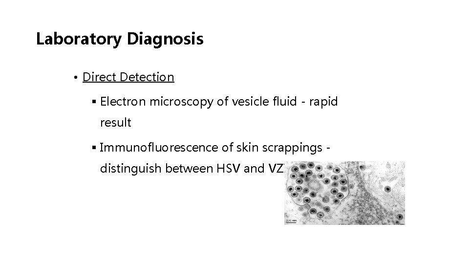 Laboratory Diagnosis • Direct Detection § Electron microscopy of vesicle fluid - rapid result