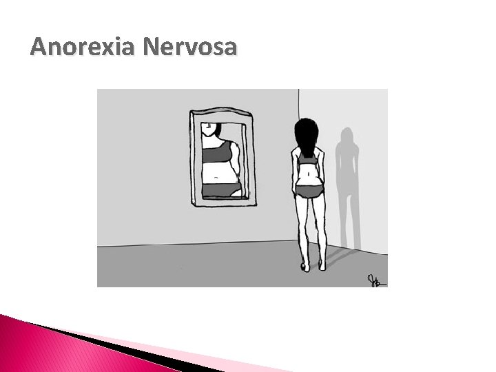 Anorexia Nervosa 