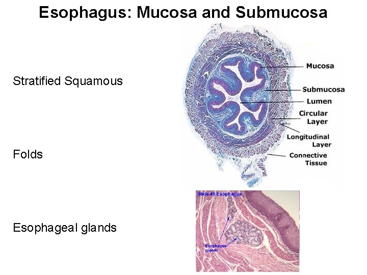 Esophagus: Mucosa and Submucosa Stratified Squamous Folds Esophageal glands 