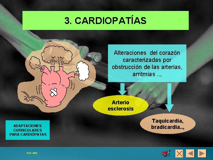 3. CARDIOPATÍAS Alteraciones del corazón caracterizadas por obstrucción de las arterias, arritmias. . ,