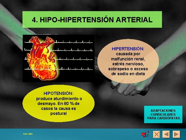 4. HIPO-HIPERTENSIÓN ARTERIAL HIPERTENSIÓN: causada por malfunción renal, estrés nervioso, sobrepeso o exceso de