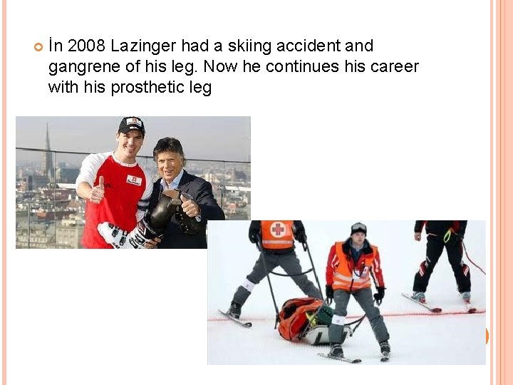  İn 2008 Lazinger had a skiing accident and gangrene of his leg. Now