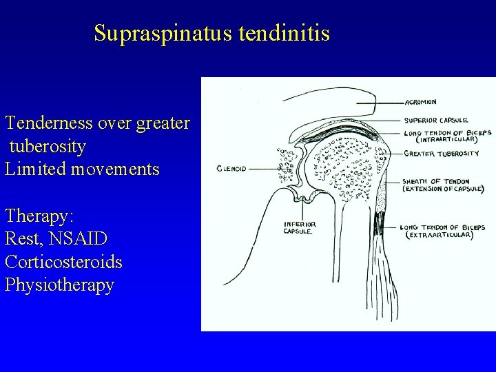 Supraspinatus tendinitis Tenderness over greater tuberosity Limited movements Therapy: Rest, NSAID Corticosteroids Physiotherapy 