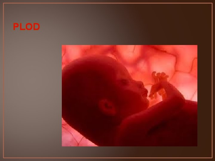 PLOD 