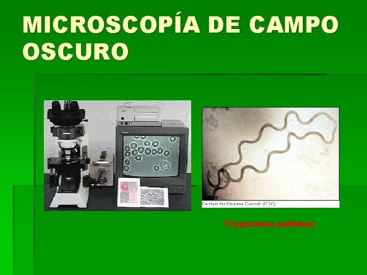 MICROSCOPÍA DE CAMPO OSCURO Treponema pallidum MICROSCOPÍA DE CAMPO OSCURO Treponema pallidum