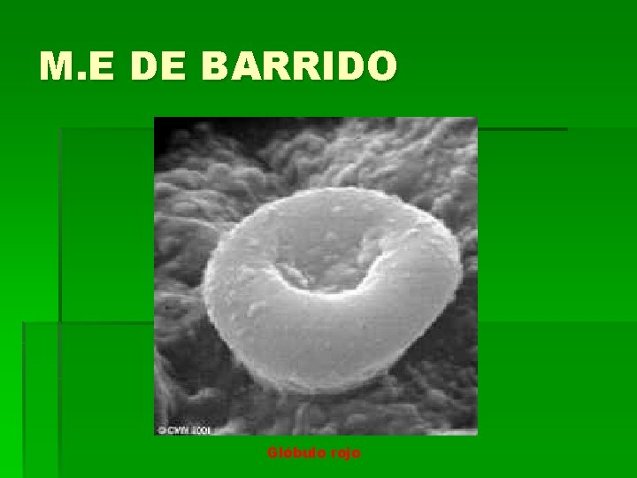 M. E DE BARRIDO Glóbulo rojo M. E DE BARRIDO Glóbulo rojo