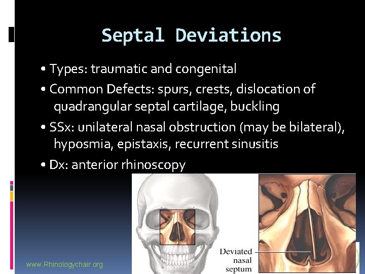 Septal Deviations • Types: traumatic and congenital • Common Defects: spurs, crests, dislocation of