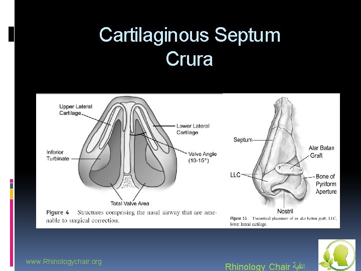 Cartilaginous Septum Crura www. Rhinologychair. org Rhinology Chair ﺍﻧﻔﻴﺔ 