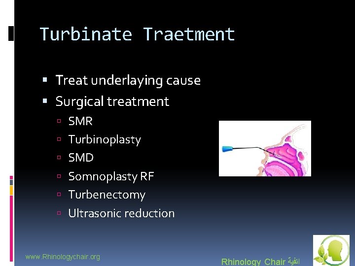 Turbinate Traetment Treat underlaying cause Surgical treatment SMR Turbinoplasty SMD Somnoplasty RF Turbenectomy Ultrasonic