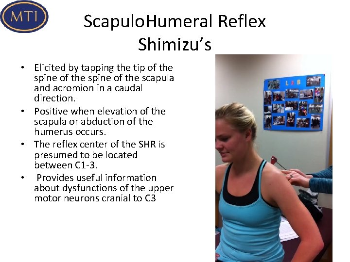 Scapulo. Humeral Reflex Shimizu’s • Elicited by tapping the tip of the spine of