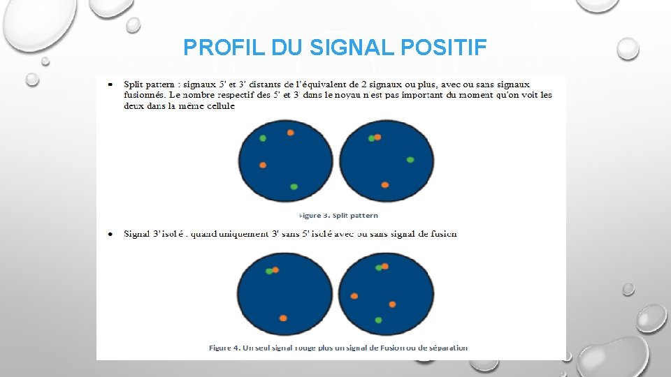 PROFIL DU SIGNAL POSITIF 