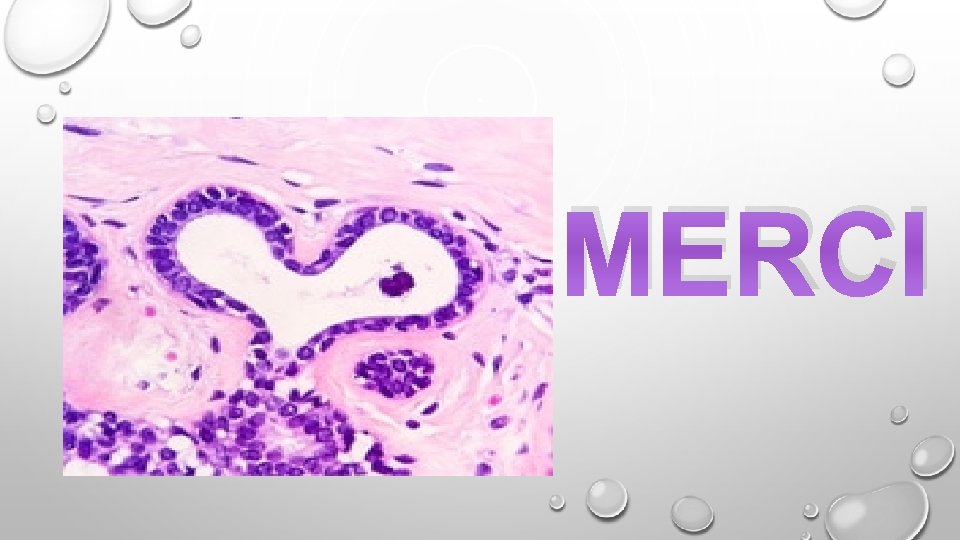 MERCI 
