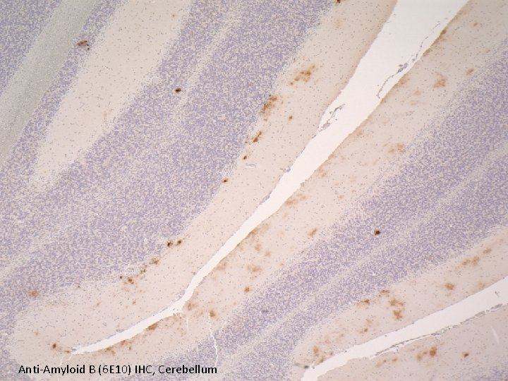 Anti-Amyloid B (6 E 10) IHC, Cerebellum 