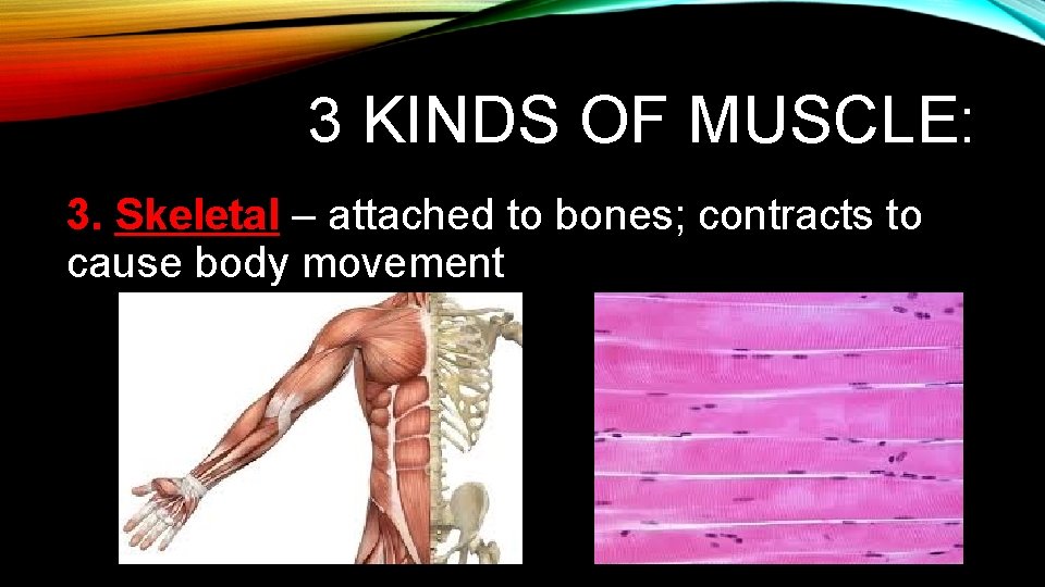 3 KINDS OF MUSCLE: 3. Skeletal – attached to bones; contracts to cause body