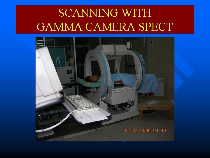 SCANNING WITH GAMMA CAMERA SPECT 