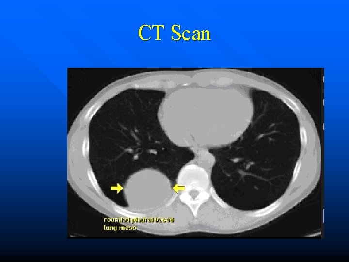 CT Scan 