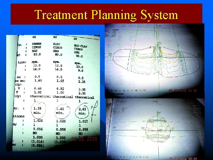 Treatment Planning System 