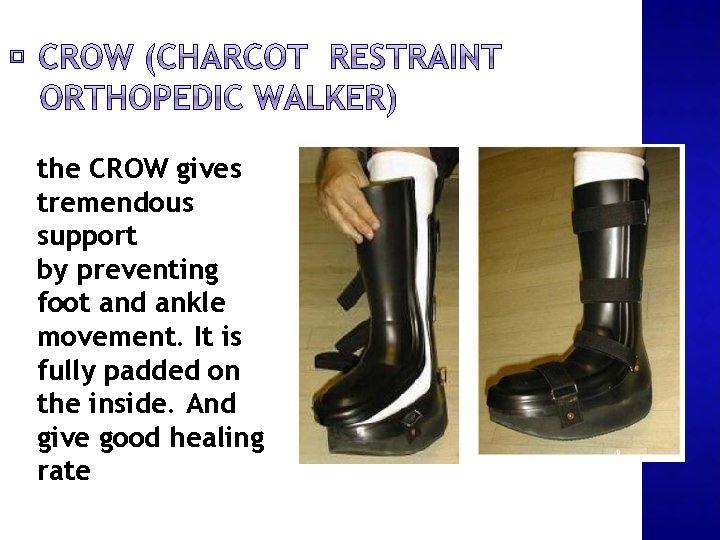 the CROW gives tremendous support by preventing foot and ankle movement. It is fully