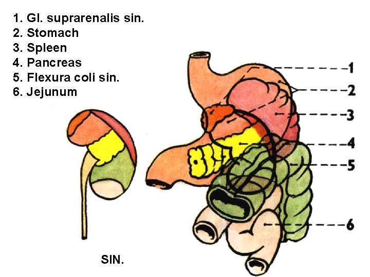 1. Gl. suprarenalis sin. 2. Stomach 3. Spleen 4. Pancreas 5. Flexura coli sin.