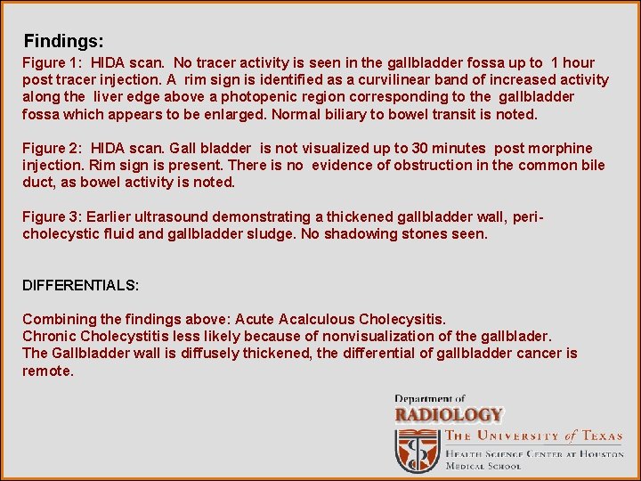 Findings: Figure 1: HIDA scan. No tracer activity is seen in the gallbladder fossa